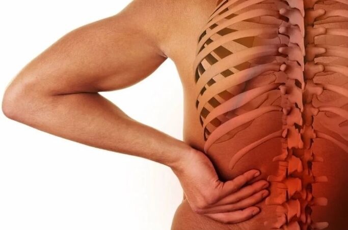 Lumbale osteochondrosis