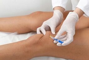 Injections into the knee joint for osteoarthritis