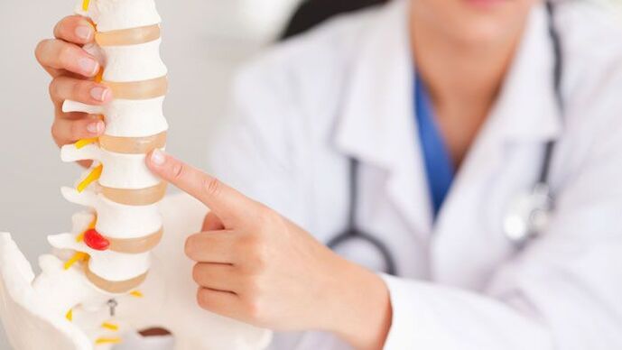 Explanation of lumbar osteochondrosis using a model of the spine